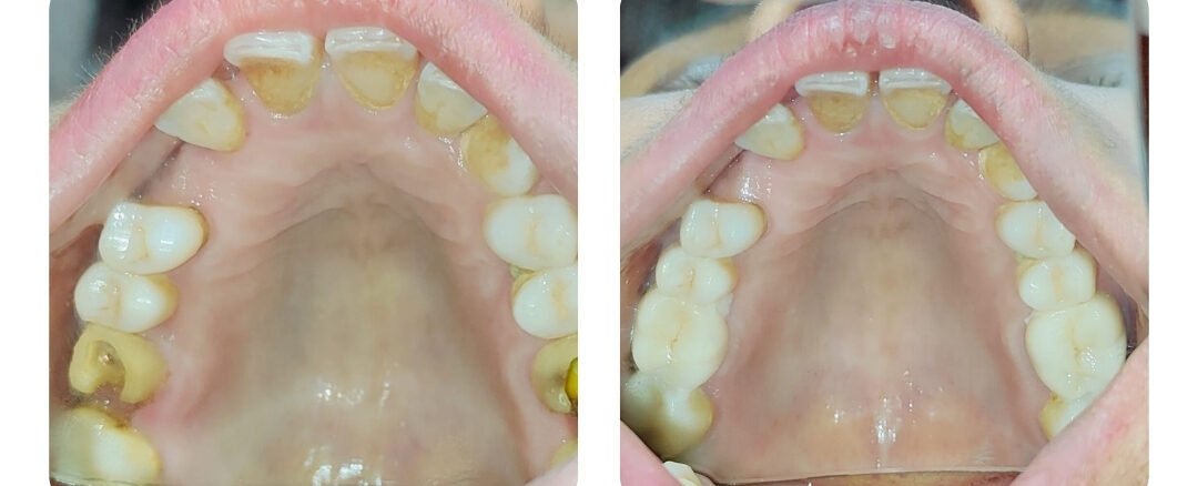 dental specialist in jaipur