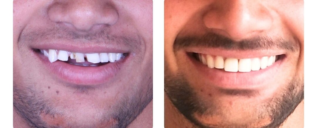 dental specialist in jaipur