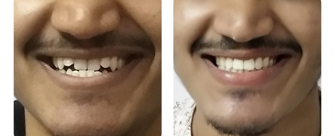top dental clinic in jaipur
