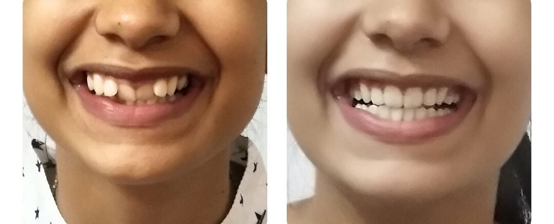 best dental clinic in jaipur