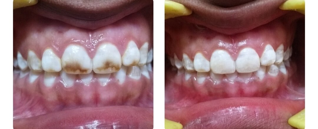 top dental clinic in jaipur