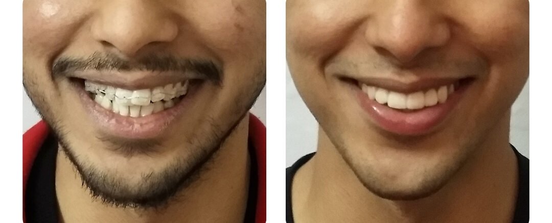 best dental clinic in jaipur