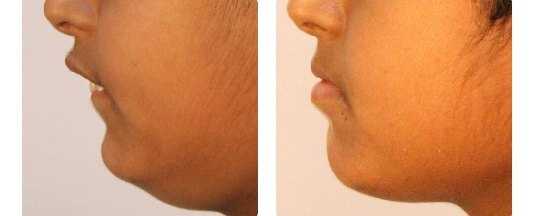 dentist in jaipur