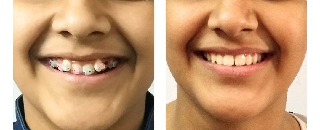 top dental clinic in jaipur