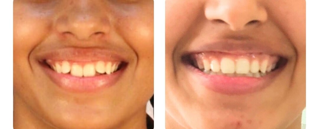 best dental clinic in jaipur