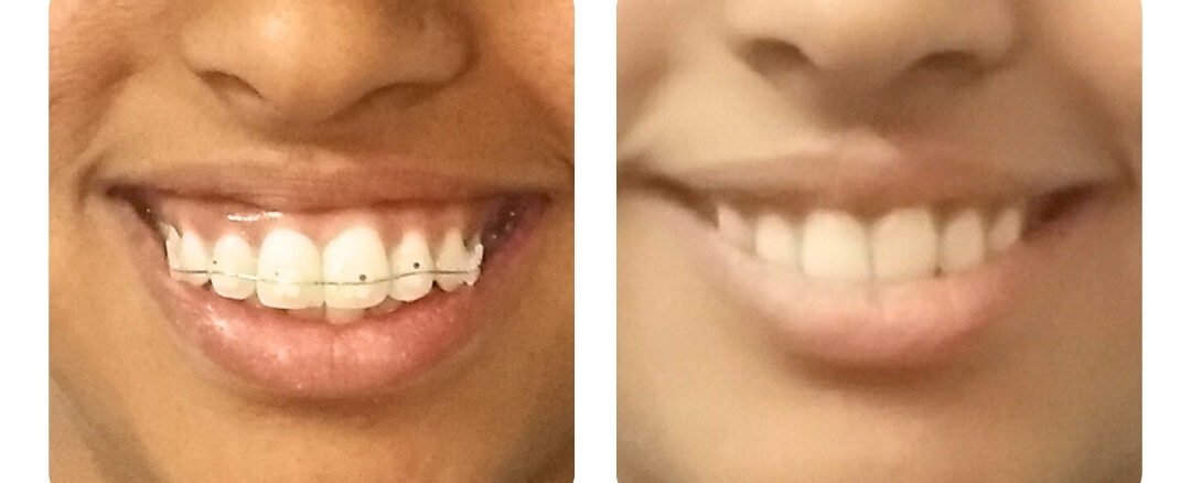 dental specialist in jaipur