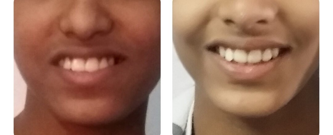 best dental clinic in jaipur