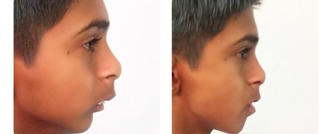 dentist in sms hospital jaipur